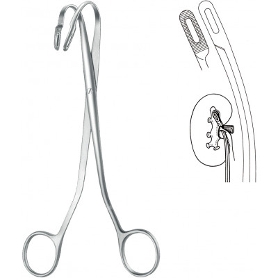 KIDNEY STONE FCP., RANDALL, NO. 1, 23 CM