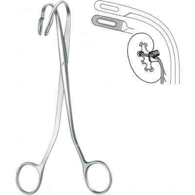 KIDNEY STONE FCP., RANDALL, NO. 2, 21 CM