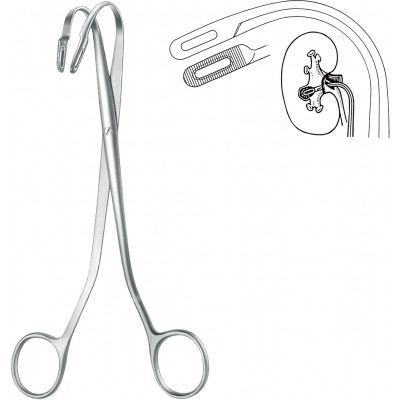 KIDNEY STONE FCP., RANDALL, NO. 3, 19 CM